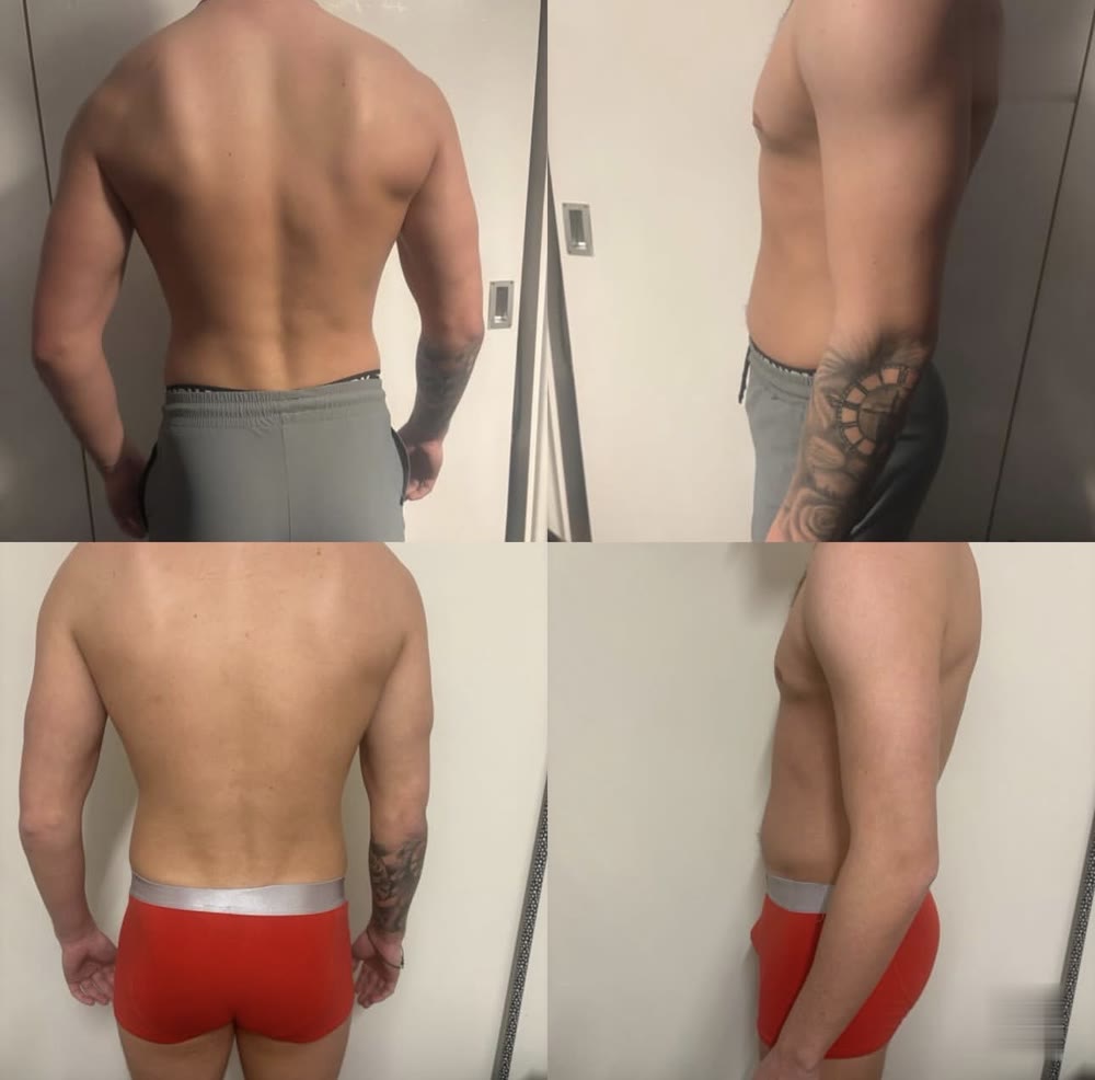 Coaching client, before and after: back and side views